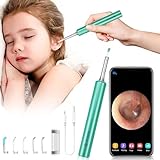oftalmoscopio welch allyn precio mexico 【Aplicaciones amplias】 El removedor de cerumen ha sido aprobado por FCC, RoHS, marca CE, y la pala para orejas de material médico de grado biológico para PC es suave y segura para conocer a diferentes personas. Puede usarlo para inspeccionar sus oídos, nariz, boca, dientes, garganta y otras partes del cuerpo. También se puede utilizar para niños, adultos y mascotas.