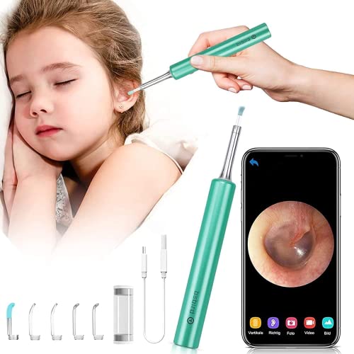 Otoscope Oreille, BEBIRD Endoscopes Camera, D'oreille Outil de Nettoyag avec 1080P FHD et 6 Lumières LED, Kits de Retrait de Cérumen Compatible avec, pour Enfants, Adultes(Vert) Cover