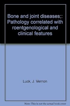 Unknown Binding Bone and joint diseases;: Pathology correlated with roentgenological and clinical features Book