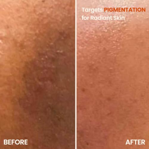 Image of Take It All Off Daily Reset Face Cleanser, Deep Cleansing, Brightening & Hydrating, helps barrier repair, Paraben-Free & Sulphate-Free, 100gm