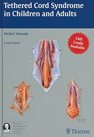 Tethered Cord Syndrome in Children and Adults 2nd Edition book cover