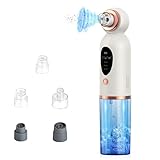 Limpiador de Poros, Blackhead Remover