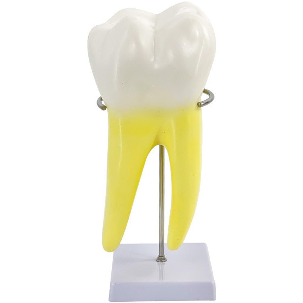 Modèle D'anatomie Modèle De Dents Molaires pour L'étude des Maladies Modèle De Dents Modèle De Dent Humaine