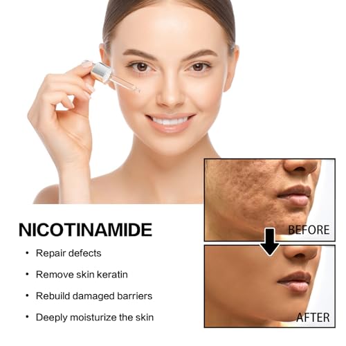 Vincofoo Nicotinamide Serum For Blemishes, Deeply Hydrating, 2Pcs Niacinamide Freckles Removal Serum,Sunnylas Niacinamide Freckles Removal Serum, Facial Serum For All Type Skin thumb #2