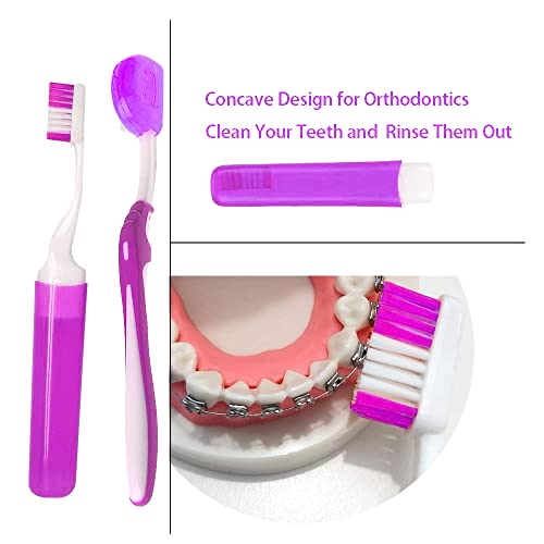 Portable Orthodontic Toothbrush Kit For Orthodontic Patient Braces Interdental Brush Dental Wax Dental Floss Toothbrush Box Oral Care Kit Aligner Removal Tool (Purple) #TOP2
