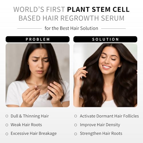 Image of Keanu Stem Cell Intensive Anti Hairfall Serum, Combats Hair loss, Boosts Hair Growth, Reactivates Dormant Follicles, Improves Density, No Minoxidil, Non Sticky, With Exosomes, For Men & Women 50ml