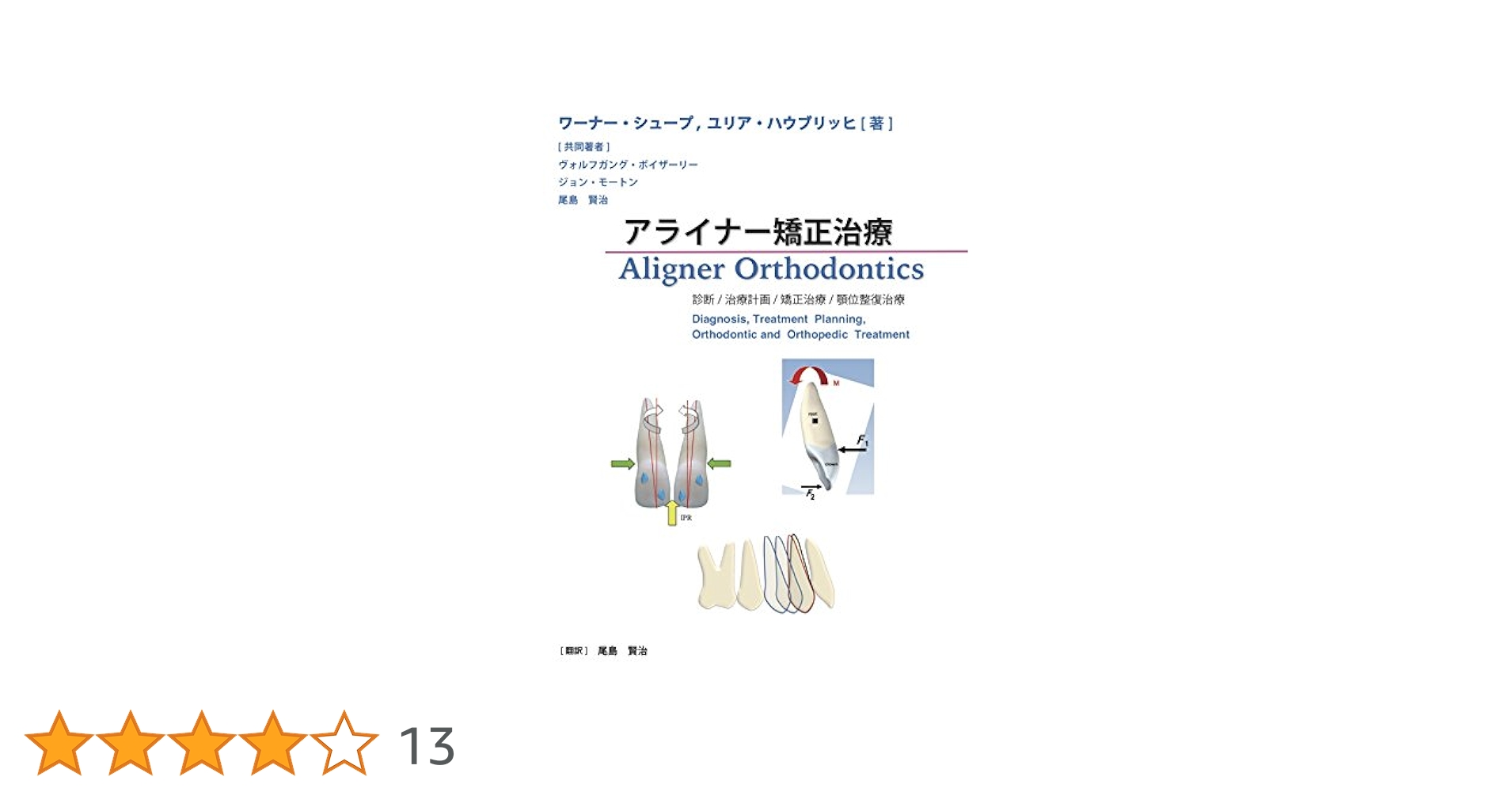 み*ん様 237 アライナー矯正治療 診断/治療計画/矯正治療/顎位整復治療 Amazon.co.jp: アライナー矯正治療 診断/治療計画/矯正治療/顎位