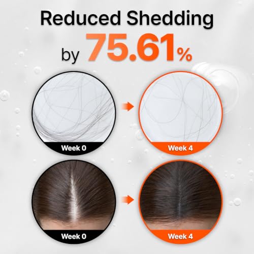 image for lilyeve GROWTURN Hair Growth Serum with Built-in Brush, Heartleaf-Deri