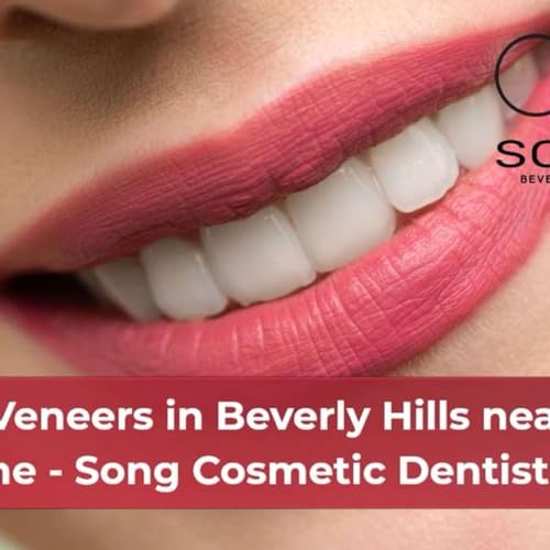 Page de couverture de Veneers in Beverly Hills near me