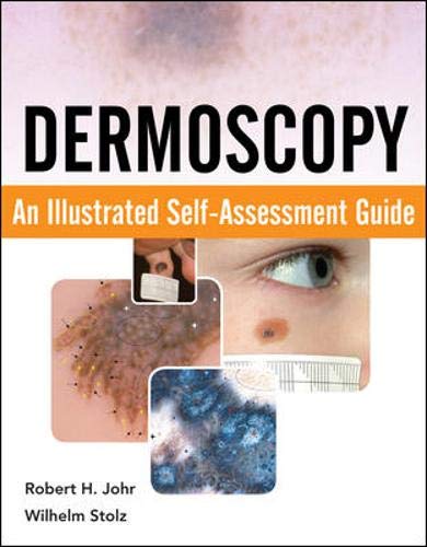 Buy Dermoscopy: An Illustrated Self-Assessment Guide — BookShops.in