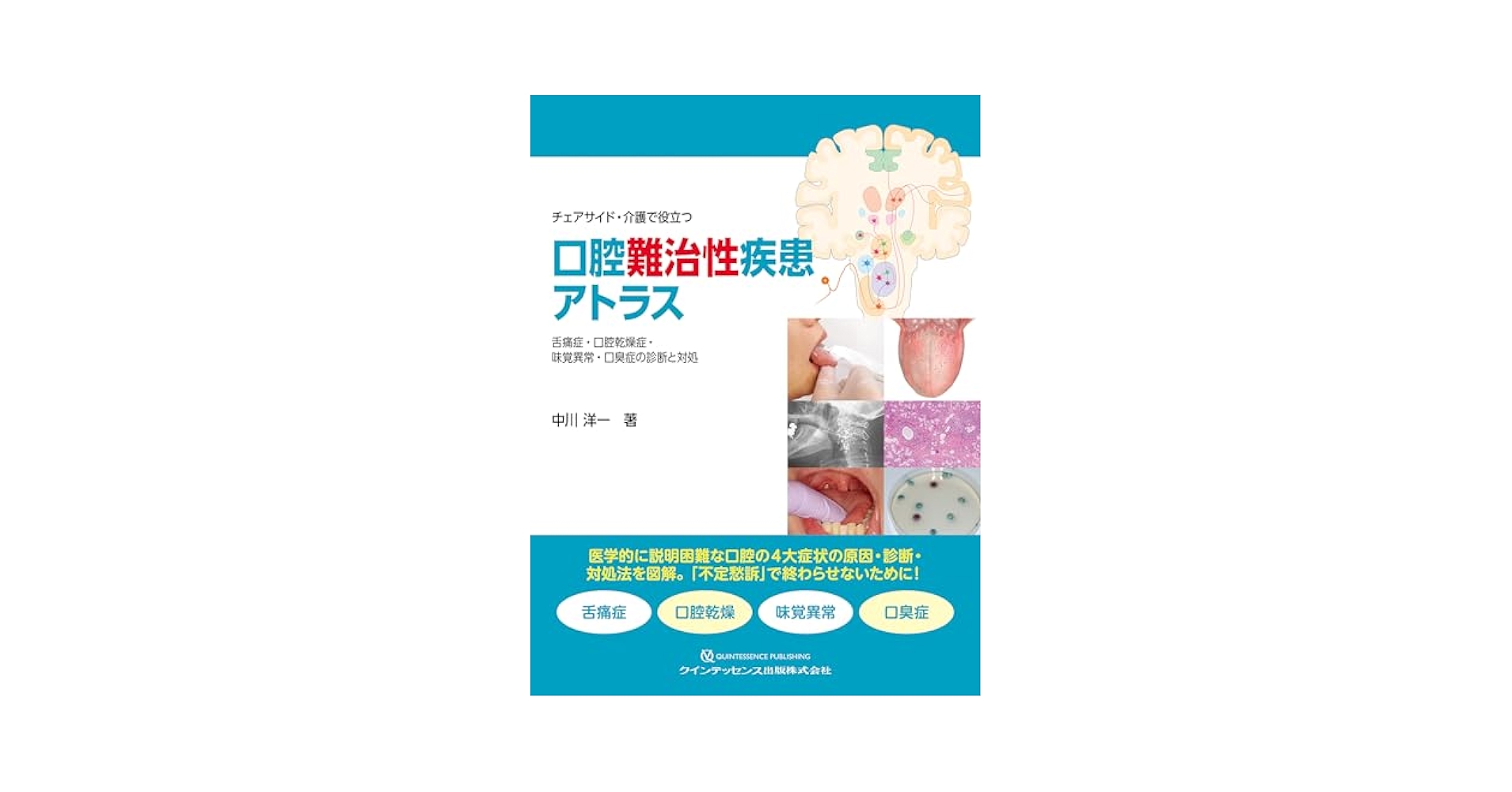 新版 チェアサイド・介護で役立つ 口腔粘膜疾患アトラス 81tkq9vdNsL._UF350,350_QL50_.jpg