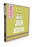 Why You Need Skin Needling