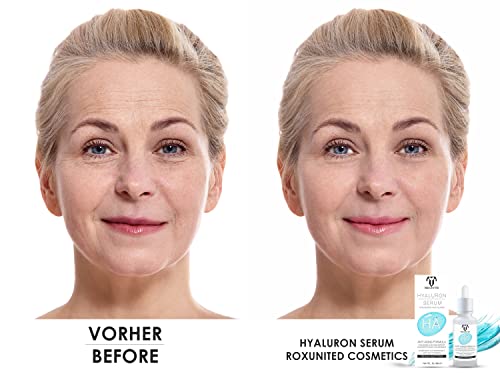 Hyaluronsäure Serum von Roxunited Hochdosiert für intensive Feuchtigkeit