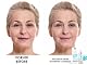 Hyaluronsäure Serum von Roxunited Hochdosiert für intensive Feuchtigkeit