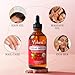 Yoken Rosehip Seed Oil for Face, 100% Pure and Natural Cold Pressed Unrefined Organic Rosehip Carrier Oil for Skin, Hair, Body & Nails - Lightweight, Fast-Absorbing (4 fl oz)