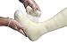 BSN Medical Cutimed - Off-Loader Total Contact Cast System (Plaster and Synthetic Combination)