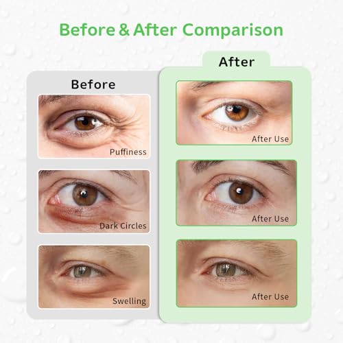 Image of 4PCS Gel Eye Ice Pack Set, Cold & Hot Compress, Reusable Cooling Gel Pads for Strain Relief, Relaxation, SPA and sleep(Green leaves)