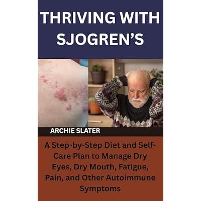 THRIVING WITH SJOGREN&rsquo;S
