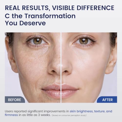 Image of Liposomal Copper Peptides Serum for Face with 1% GHK-Cu & Hyaluronic Acid | NAD+, 5 Peptides 5D Ceramides - Advanced Korean Anti-Aging Plumping Blue Serum for Fine Lines and Skin Elasticity, 1 Fl Oz