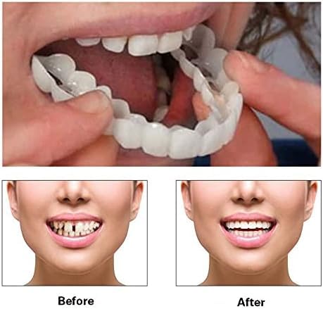 Image of 2 Pairs, Adjustable for Men and Women, Regain Confidence Smile, Nature and Comfortable-C03