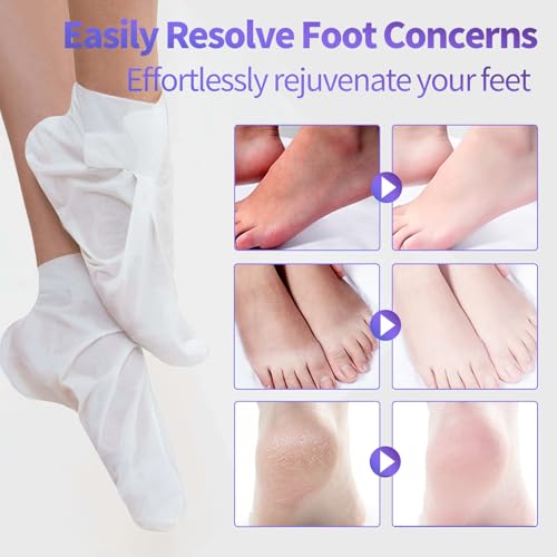 Moisturizing Foot Mask 5 Pack,Hydrating Foot Masks for Dry Cracked Feet,Moisturizing Socks Dry Skin Moisturizer for Soft and Smooth Touch Feet,Foot Care Spa Gifts for Women Men Mother\'s Day Gifts