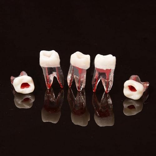 Debksgeoti DEBKSGEOTI-M8008-36#-10 Dental Root Canal Pulp Cavity Practice Endodontic Pulp-Opened Rct Teeth Model M8008 16# Typodont Standard 1:1 Teach Study 5 Pcs thumb #6