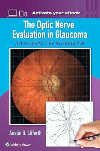  The Optic Nerve Evaluation in Glaucoma: An Interactive Workbook
