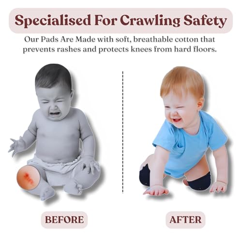 Image of Windson Baby Knee Pads Set of 4 Pairs for Toddlers, Baby Elbow & Knee Protector, Anti-Slip Silicone Dots, Knee Support for Crawling & Walking, Soft, Stretchable, Breathable Mesh (Multi-Colour)