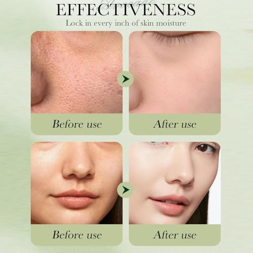 6pcs-Avocado-Skincare-Kit-Skin-Care-Gift-Set-with-Facial-Cleanser-Toner-Lotion-Face-Serum-Face-Cream-Eye-Cream-For-Hydrating-Skin-Anti-Aging-Skin-For-Women-Teen-Girls-Large-6-Count