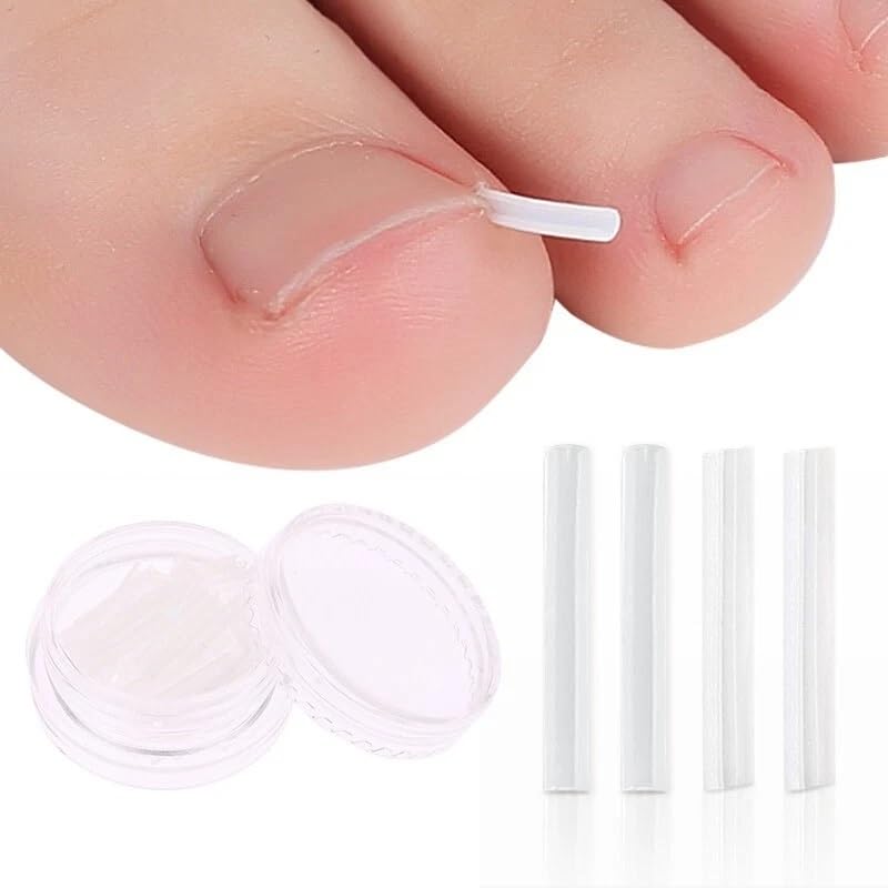 20Pcs Ingrown Toenail Correction Strips Brace Kit,Ingrown Toenail Corrector Straightener Strips Recover Clips Toenails Thick Pedicure Tool Toenail Straightener Strip