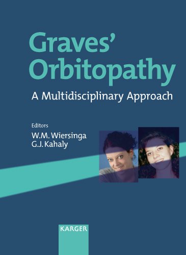Buy Graves' Orbitopathy: A Multidisciplinary Approach — BookShops.in