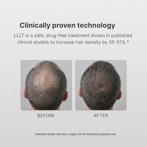Image of Turbo Pro Laser Hair Growth Cap with 316 Lasers - 6 Minute Treatment Time for Thinning Hair | Hair Loss Treatment | Hair Regrowth Cap for Men and Women