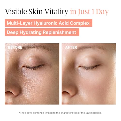 Image of PeachMicrobiome 84 EGF Peach Serum, Niacinamide & Allantoin to Support Skin Barrier and Calm Skin - Suitable for Sensitive Skin Types, Korean Skin Care (30ml / 1.01 fl. oz.)