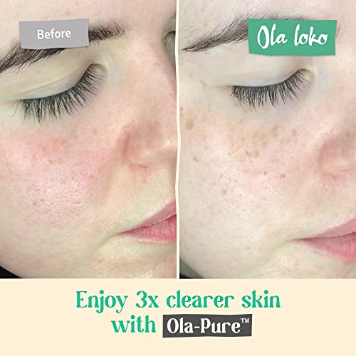 Mud Mask for Face and Body, Detox Face Mask Skincare, Exfoliating Face Mask - Image 3
