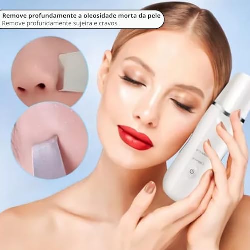 Espátula De Peeling Ultrassônico E Ionização Facial Removedor Cravos Portátil Limpeza Profunda Skin