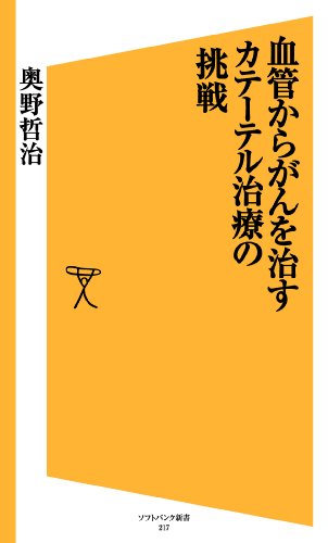血管からがんを治す カテーテル治療の挑戦 (SB新書)
