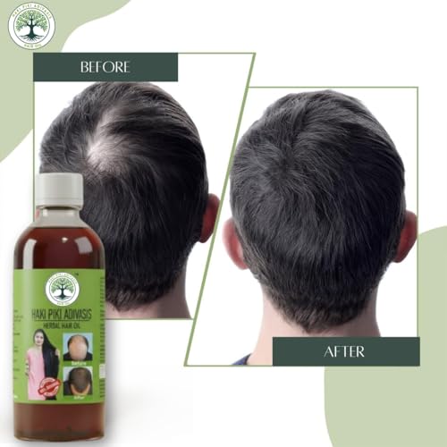 Image of Original Adivasis Hair Growth Oil 2 x 125 ml,Anti‑Hairfall & Anti‑Dandruff with Onion, Castor, Rosemary, Coconut, Amla, Bhringraj & Brahmi |for Men & Women (Pack of 2)