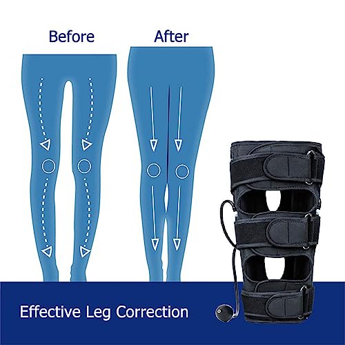 Correcteur de posture pour jambes arquées à utiliser à la maison - 3