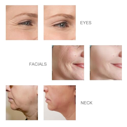 Lefay NEWFM-BMJ03 Face Skin Tightening Device thumb #5