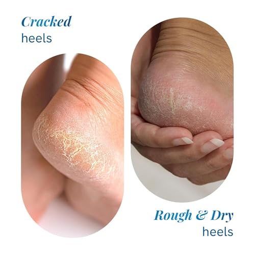 Be Bodywise 20% Urea Foot Cream Roll On 75ml | For Dry & Cracked Heels | With 2% Lactic Acid, Vitamin E & Olive Oil | Helps Moisturise and Repair... - Image 3