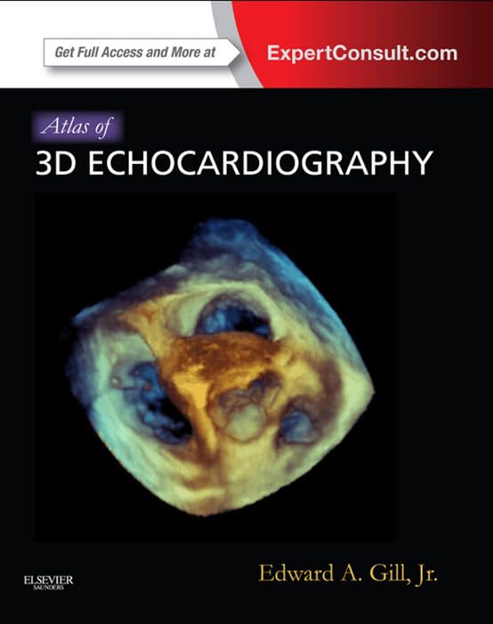 Atlas of 3D Echocardiography E-Book: Expert Consult – Online