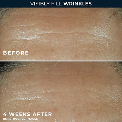 RoC Retinol Correxion Deep Wrinkle Filler