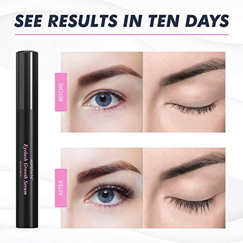 (80 OFF) Eyelash Growth Serum 8.00 Coupon Code