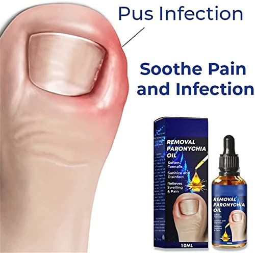 3 PCS olio per la cura della rimozione della