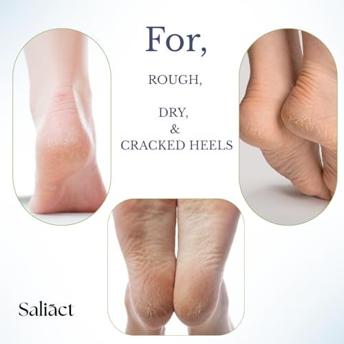 Image of 20% Urea Foot Cream Roll On With Salicylic Acid, Lactic Acid, Olive Oil | Moisturizer for Dry Cracked Feet | Repair and Moisturise Cracked Heels | Hydrates & Nourish Foot Care for Softens Skin | For Women & Men | 50ML (Normal, 100 ml)