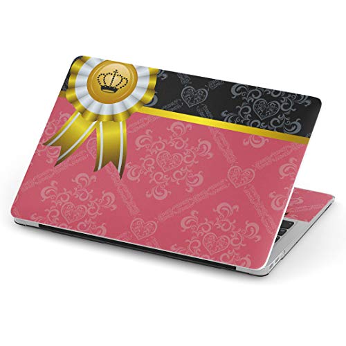igsticker MacBook Air 13inch 2018 2019 2020 f / A1932 pXLV[ }bNubN GA Mac 13" C` Retina pV[ tB XebJ[ ANZT[ ی (2010N 