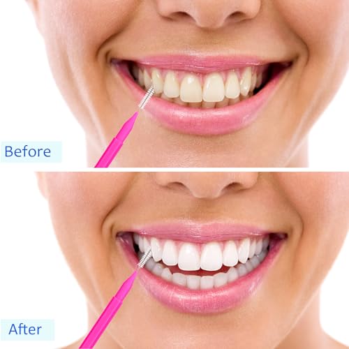 Image of Patelai 100 Pieces Braces Dental Brush for Cleaner Interdental Toothpick Dental Tooth Flossing Head Oral Hygiene Flosser Toothpick Cleaners Tooth Tool(Pink,Portable Size)