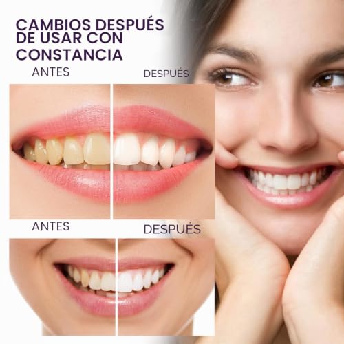 Miniatura 6 de Pasta Blanqueadora Dientes 30ml, Purple Blanqueador Dental, Color Corrector Serum Dientes, Dental Pasta de Dentes Blanqueante, Remoción de Manchas Dentales, Whiten and Brighten