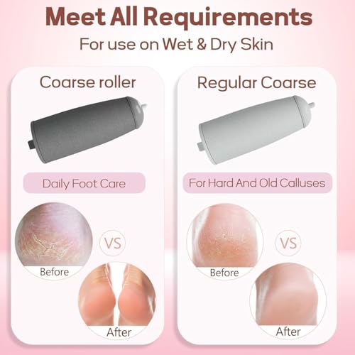 Image of callus remover for feet dead skin remover pedicure tools Callus Remover Hard and Dead Skin Remover Electric Foot Callus Remover Rechargeable Pedicure Tool (2026 UPDATE).