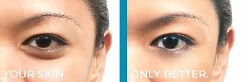 BE YOU SKIN | Skin Perfecting Conceal | RADIANT — view 3
